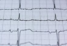 revenue node luminary pulse
